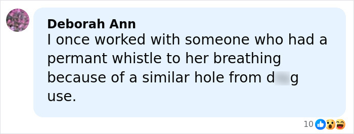 Comment by Deborah Ann discussing the impact of substance use on breathing and facial damage in a social media post. Comment by Deborah Ann discussing the impact of substance use on breathing and facial damage in a social media post.