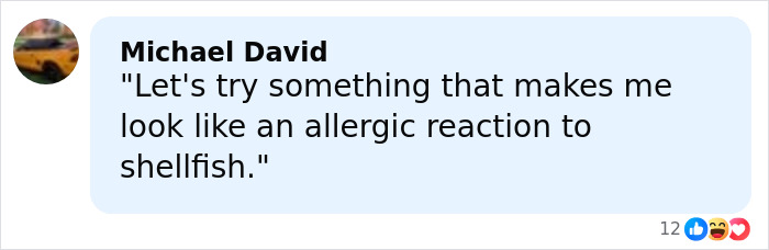 Comment by Michael David humorously mentioning wanting to look like an allergic reaction to shellfish online. Comment by Michael David humorously mentioning wanting to look like an allergic reaction to shellfish online.