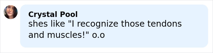 Comment from Crystal Pool stating she recognizes tendons and muscles, relating to claim about skinned body in Las Vegas museum.