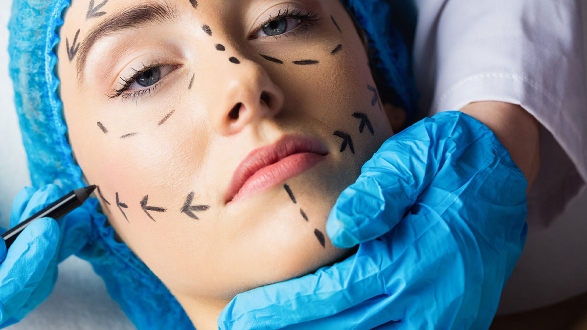 Woman with plastic surgery markings on face, doctor wearing blue gloves preparing for cosmetic procedure.