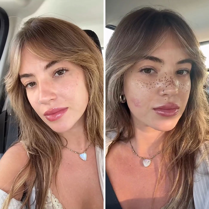 Side-by-side images of a woman before and after getting freckles tattooed on her face, showing the bold new look. Side-by-side images of a woman before and after getting freckles tattooed on her face, showing the bold new look.