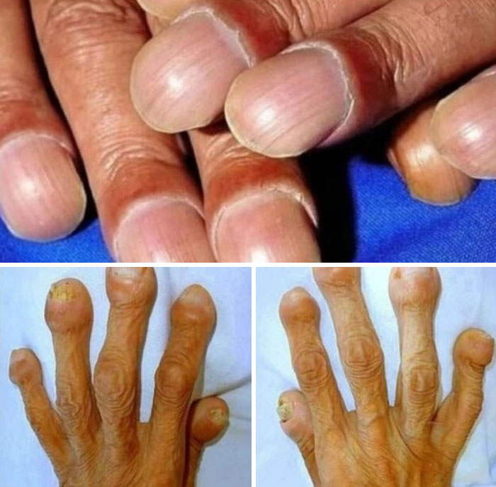Close-up images of unusually shaped fingers and nails, highlighting strange facts about our world’s human diversity.