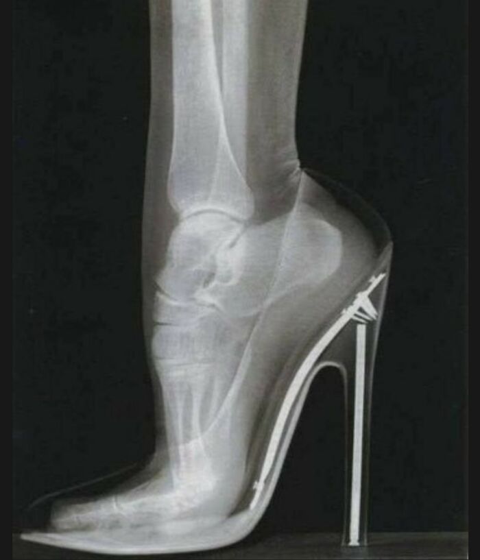 X-ray image of a foot inside a high heel shoe illustrating strange facts about the human body and world.