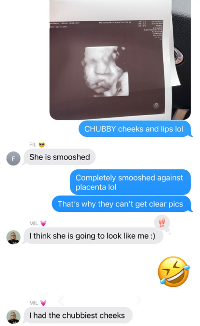 Text conversation showing unhinged MIL texts about an ultrasound image discussing chubby cheeks and resemblance.