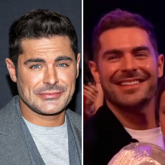 Side-by-side images of Zac Efron showing changes in his back to normal face as experts discuss what happened. Side-by-side images of Zac Efron showing changes in his back to normal face as experts discuss what happened.
