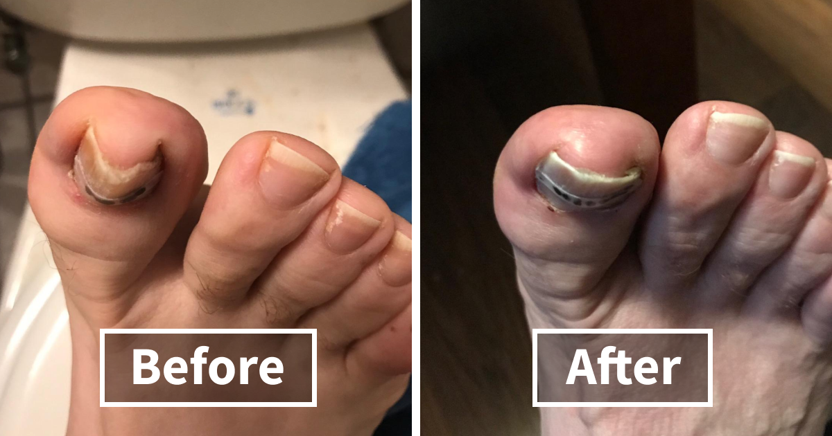 “Imagine Falling Into It”: 110,000 Spiders Built World’s Biggest Web, And It’s Absolute Nightmare Fuel