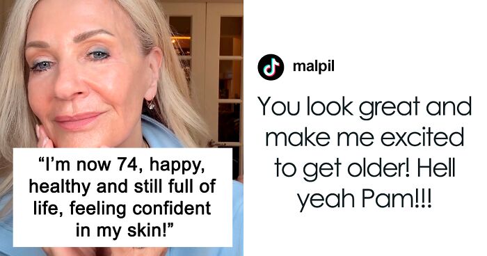 Woman Shares Her Aging Progress And How She Looks After Getting A Facelift At 70 Years Old