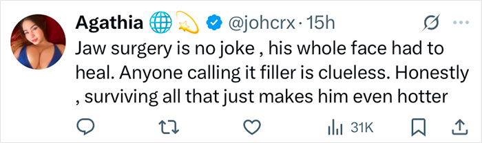 Tweet discussing Zac Efron's back to normal face after jaw surgery, with opinions on his appearance and recovery. Tweet discussing Zac Efron's back to normal face after jaw surgery, with opinions on his appearance and recovery.