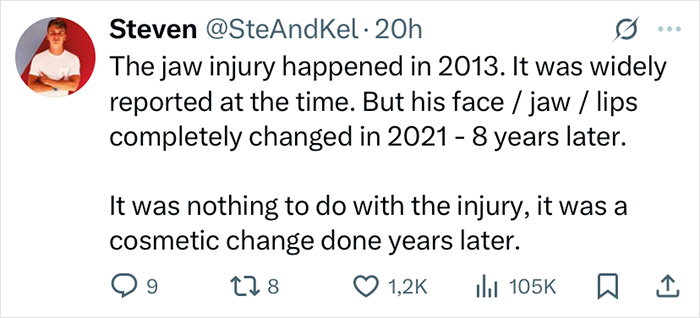 Tweet explaining Zac Efron's back to normal face change, noting cosmetic work years after 2013 jaw injury, with expert commentary. Tweet explaining Zac Efron's back to normal face change, noting cosmetic work years after 2013 jaw injury, with expert commentary.