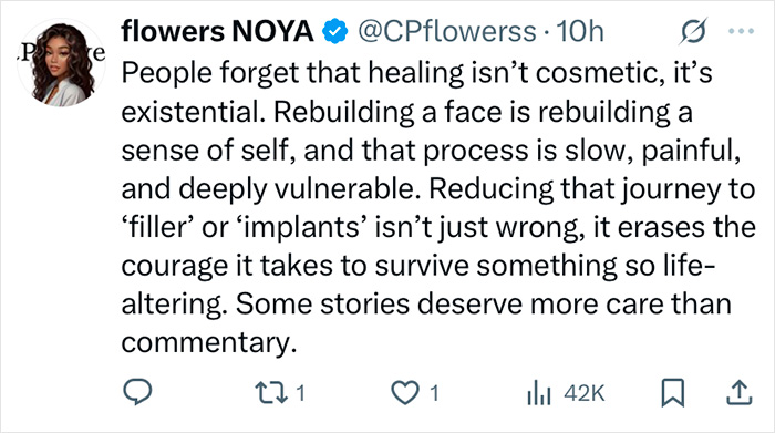 Tweet from flowers NOYA discussing the emotional process of healing the face beyond cosmetic treatments. Tweet from flowers NOYA discussing the emotional process of healing the face beyond cosmetic treatments.
