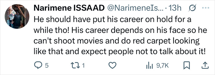 Tweet discussing Zac Efron's back to normal face and public reaction to changes in his appearance. Tweet discussing Zac Efron's back to normal face and public reaction to changes in his appearance.