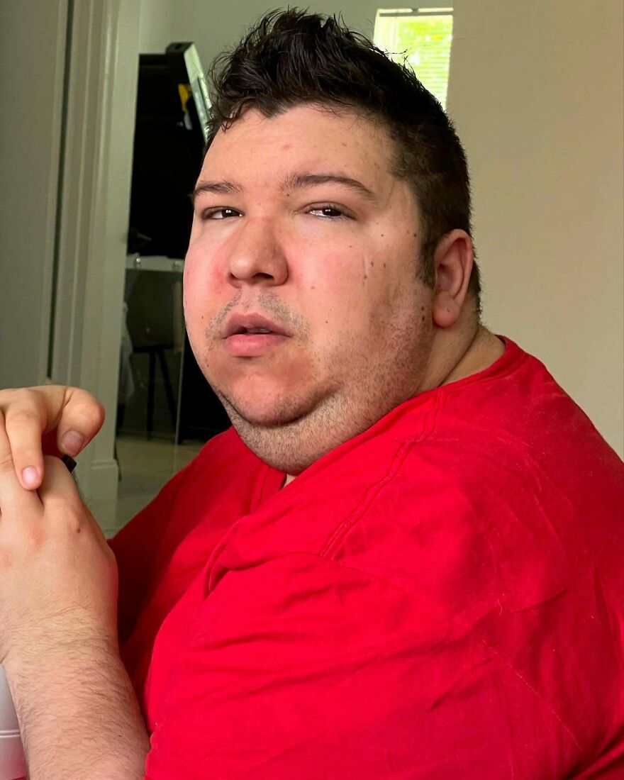 Nikocado Avocado in a red shirt sitting indoors, showing his face and neck after cosmetic surgery results.