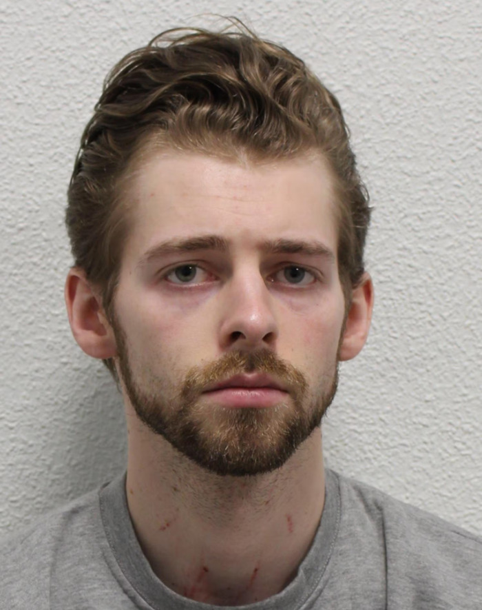 Young US student with a serious expression, showing marks on his neck after altercation with girlfriend, against plain wall background Young US student with a serious expression, showing marks on his neck after altercation with girlfriend, against plain wall background