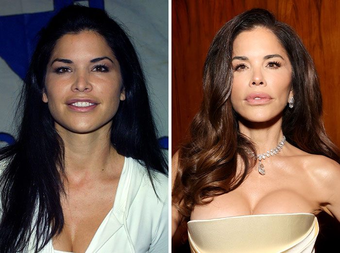 Before and after Mar-a-Lago face transformations showing dramatic changes with makeup, styling, and possible cosmetic enhancements. Before and after Mar-a-Lago face transformations showing dramatic changes with makeup, styling, and possible cosmetic enhancements.