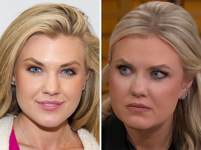 Side-by-side comparison of a blonde woman showing a Mar-a-Lago face transformation with different facial expressions.
