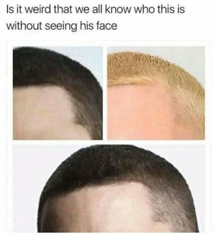 Close-up of different hairlines with text highlighting how recognizable someone is without seeing their face in funny stress-relief memes.