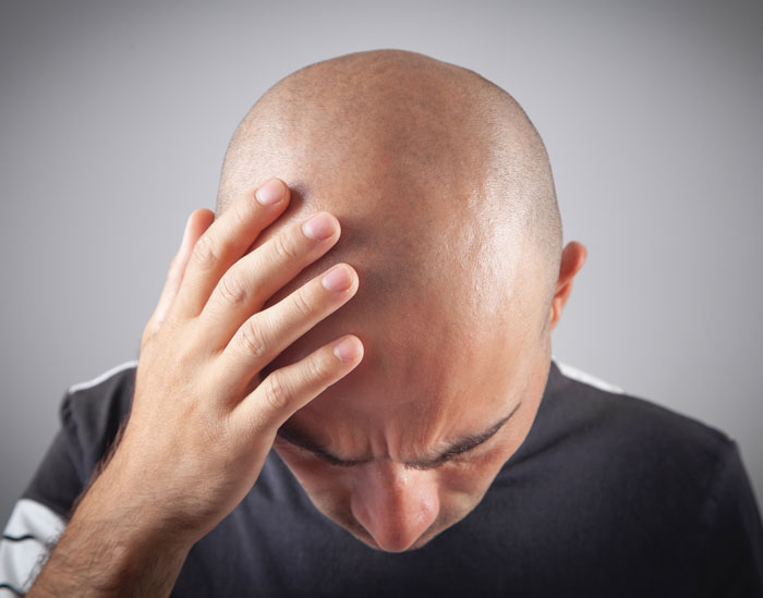 Bald man holding his head in frustration, illustrating a spicy roast that left parents’ jaws hanging.