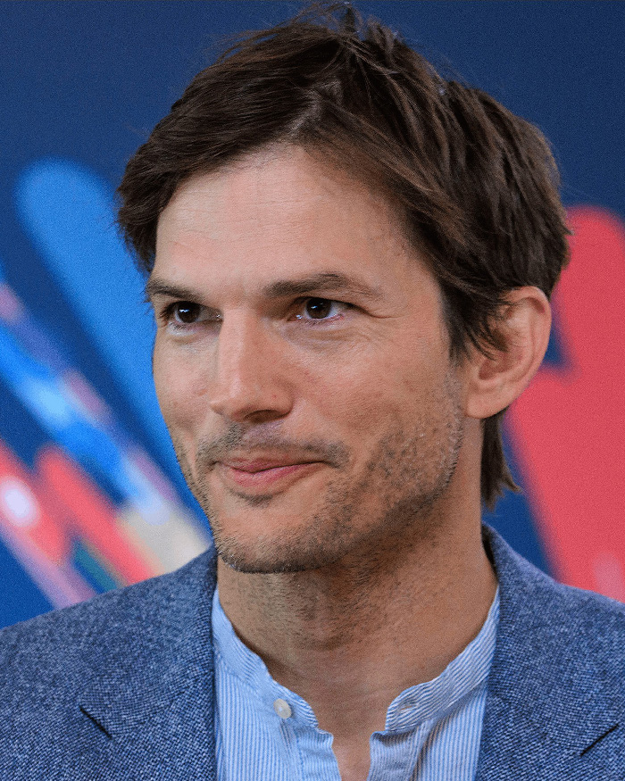 Close-up of Ashton Kutcher wearing a blue jacket and shirt, representing celebrities with rare conditions in public.