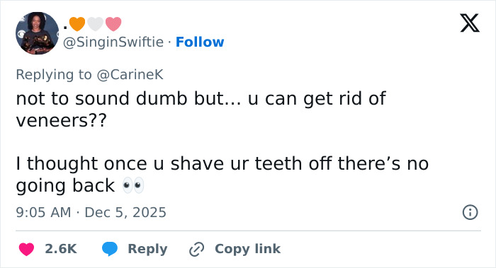 Tweet discussing the possibility of removing veneers and concerns about irreversible teeth shaving in a casual tone.