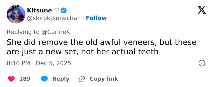 Tweet discussing Miley Cyrus’s youthful glow and viral makeover after removing old veneers and getting a new set of teeth.