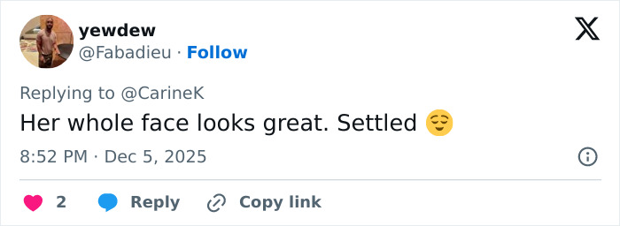 Miley Cyrus’s youthful glow and viral makeover spark frenzy after she took the veeners out in a fresh new look.