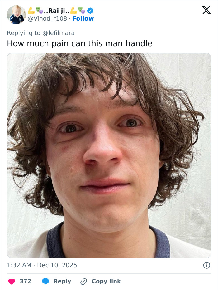 Close-up of a young man with messy hair and a bruised face reacting to Robert Pattinson and Zendaya's viral engagement ad. Close-up of a young man with messy hair and a bruised face reacting to Robert Pattinson and Zendaya's viral engagement ad.