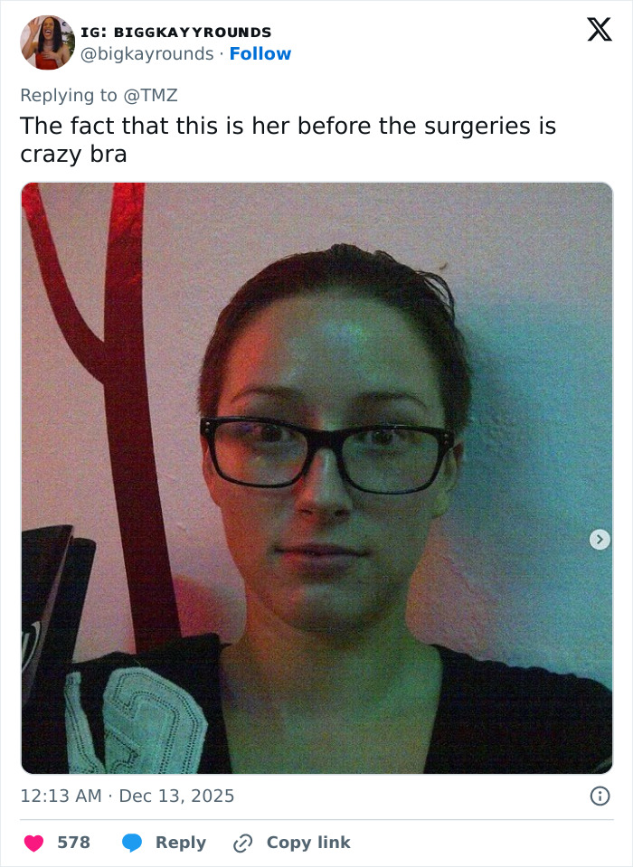 "She Was Not Well": Mary Magdalene, 33, Influencer Known For Extreme Cosmetic Surgeries, Passes Away After High‑Rise Fall "She Was Not Well": Mary Magdalene, 33, Influencer Known For Extreme Cosmetic Surgeries, Passes Away After High‑Rise Fall