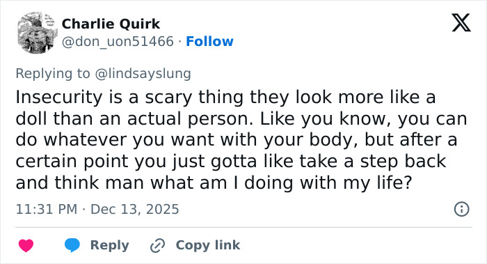 "She Was Not Well": Mary Magdalene, 33, Influencer Known For Extreme Cosmetic Surgeries, Passes Away After High‑Rise Fall "She Was Not Well": Mary Magdalene, 33, Influencer Known For Extreme Cosmetic Surgeries, Passes Away After High‑Rise Fall