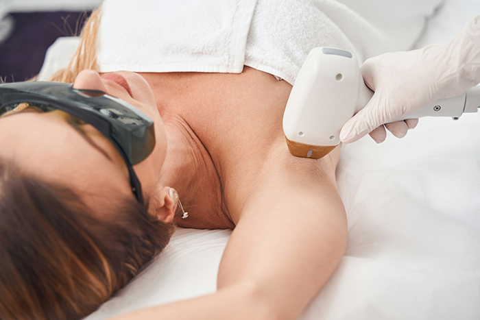 Woman wearing protective glasses receiving laser hair removal treatment on her underarm from gloved technician.