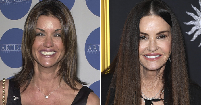 Side-by-side photos of a female celebrity before and after plastic surgery, highlighting changes and outcomes.