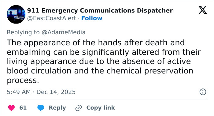 Tweet discussing the altered appearance of hands after death and embalming, explaining changes in circulation and preservation effects. Tweet discussing the altered appearance of hands after death and embalming, explaining changes in circulation and preservation effects.