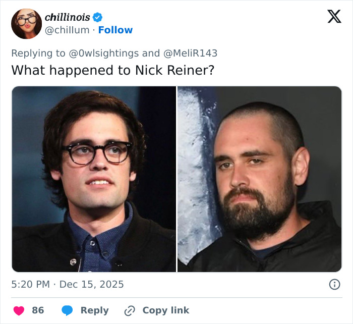 Side-by-side photos of two men with different hairstyles, related to Trump under fire for TDS post controversy. Side-by-side photos of two men with different hairstyles, related to Trump under fire for TDS post controversy.