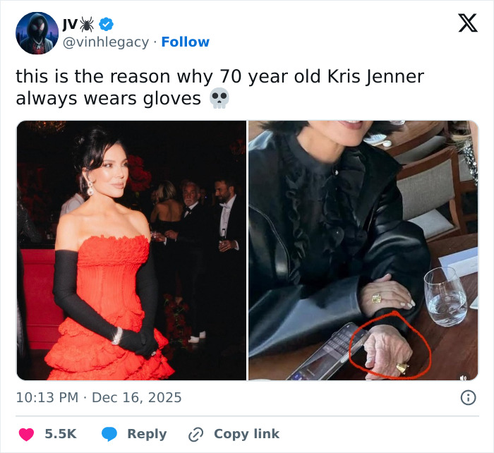Kris Jenner ditches gloves in public revealing hands after viral $100k facelift discussions with close-up on aged hands. Kris Jenner ditches gloves in public revealing hands after viral $100k facelift discussions with close-up on aged hands.