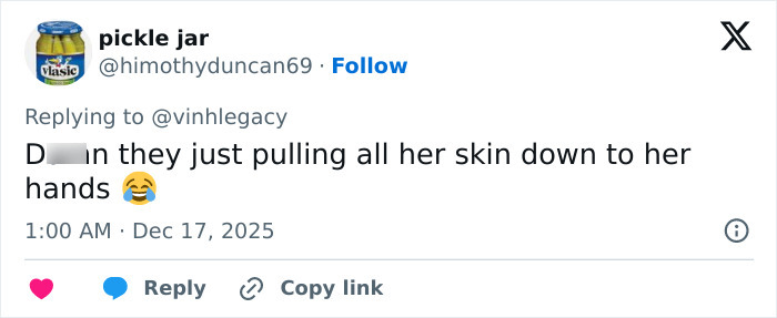 Tweet text commenting on Kris Jenner’s hands after her viral $100k facelift, mentioning skin pulled down to hands. Tweet text commenting on Kris Jenner’s hands after her viral $100k facelift, mentioning skin pulled down to hands.