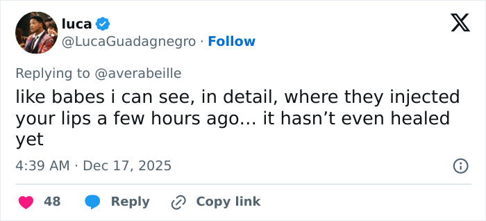 Social media post defending Karoline Leavitt’s close-up photo amid lip filler mark mockery discussions. Social media post defending Karoline Leavitt’s close-up photo amid lip filler mark mockery discussions.