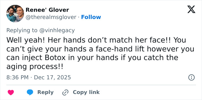 Twitter reply discussing hands aging and Botox, mentioning the viral $100k facelift and hands never lie keyword. Twitter reply discussing hands aging and Botox, mentioning the viral $100k facelift and hands never lie keyword.
