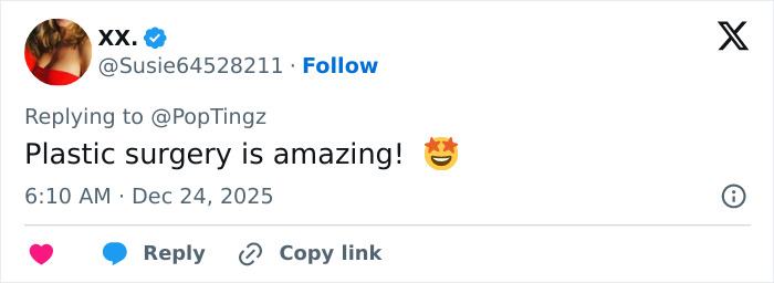 "Eles realmente fizeram Photoshop nela": Sessão fotográfica de lingerie natalina de Madonna provoca frenesi