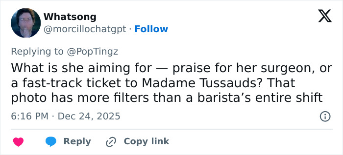 "Eles realmente fizeram Photoshop nela": Sessão fotográfica de lingerie natalina de Madonna provoca frenesi