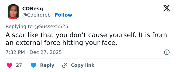 Tweet discussing Kate Middleton's scar and conspiracy theories about cancer during her Christmas appearance. Tweet discussing Kate Middleton's scar and conspiracy theories about cancer during her Christmas appearance.