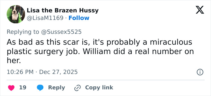 Tweet discussing Kate Middleton’s scar, prompting wild conspiracy theories about her never having cancer.