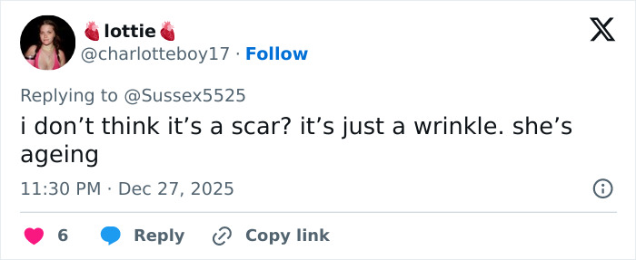 Screenshot of a Twitter comment discussing Kate Middleton's alleged scar during a Christmas appearance, sparking conspiracy theories. Screenshot of a Twitter comment discussing Kate Middleton's alleged scar during a Christmas appearance, sparking conspiracy theories.