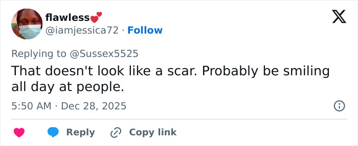 Screenshot of a tweet discussing Kate Middleton's scar during Christmas appearance sparking conspiracy theories.