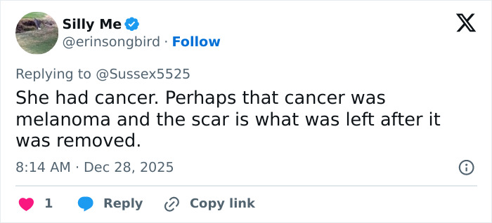 Tweet discussing Kate Middleton's scar during Christmas appearance fueling cancer and conspiracy theories online. Tweet discussing Kate Middleton's scar during Christmas appearance fueling cancer and conspiracy theories online.