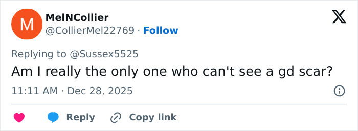 Tweet questioning visibility of Kate Middleton's scar during Christmas appearance sparking cancer conspiracy theories. Tweet questioning visibility of Kate Middleton's scar during Christmas appearance sparking cancer conspiracy theories.