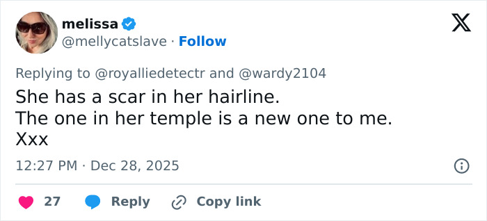 Tweet discussing Kate Middleton&rsquo;s facial scar and rumors about the severity of her 2024 hospitalization.