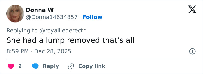 Screenshot of a Twitter reply discussing Kate Middleton&rsquo;s facial scar and its link to her 2024 hospitalization rumors.