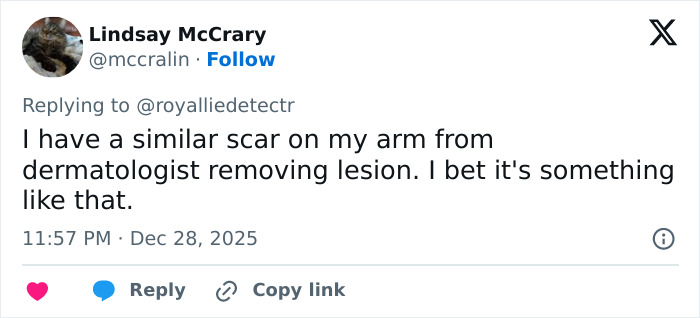 Twitter comment discussing a facial scar related to Kate Middleton’s 2024 hospitalization rumors. Twitter comment discussing a facial scar related to Kate Middleton’s 2024 hospitalization rumors.