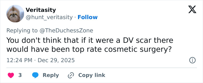 Screenshot of a tweet discussing Kate Middleton’s facial scar and speculating on the seriousness of her 2024 hospitalization. Screenshot of a tweet discussing Kate Middleton’s facial scar and speculating on the seriousness of her 2024 hospitalization.