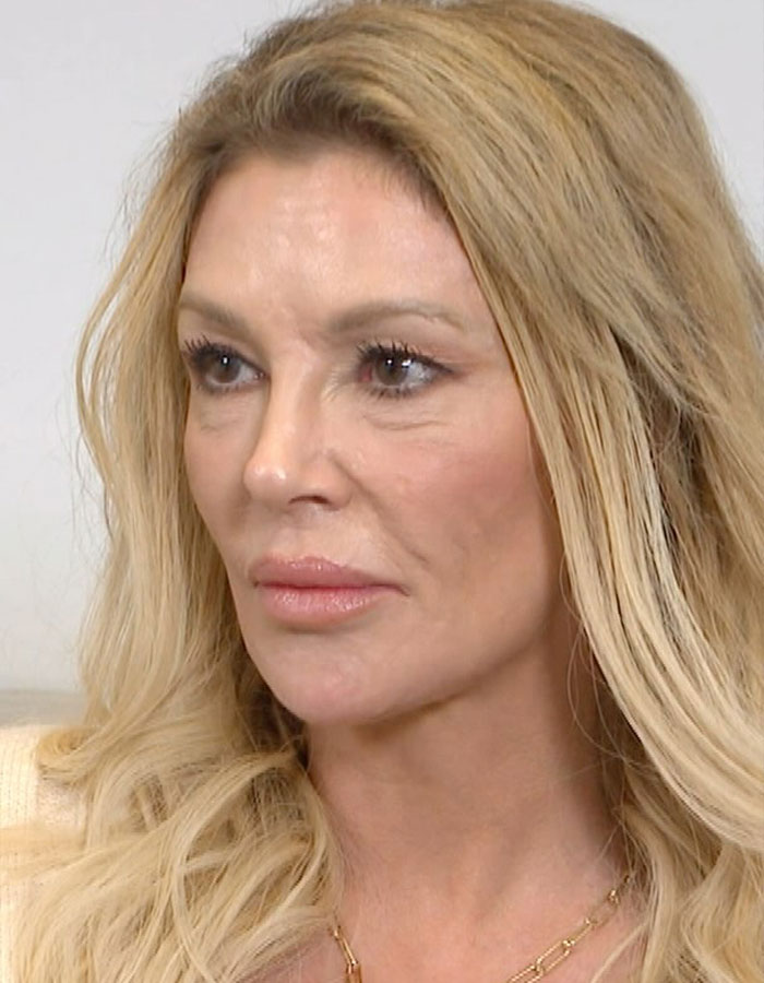 Brandi Glanville with blonde hair and natural makeup, discussing facial disfigurement diagnosis in an indoor setting. Brandi Glanville with blonde hair and natural makeup, discussing facial disfigurement diagnosis in an indoor setting.