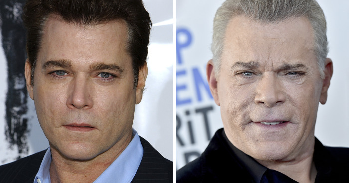 Side-by-side images of a male celebrity before and after plastic surgery showing noticeable facial changes and aging effects.